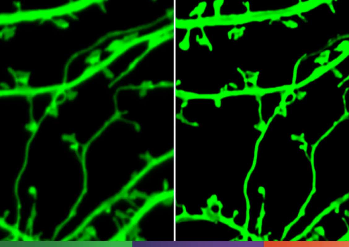 Российские ученые улучшили микроскоп